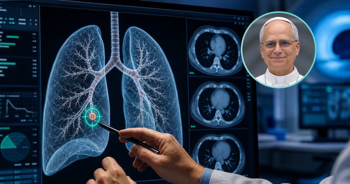 Tres milímetros que cambiarían la agenda del Papa: cuándo se opera un nódulo pulmonar casi invisible